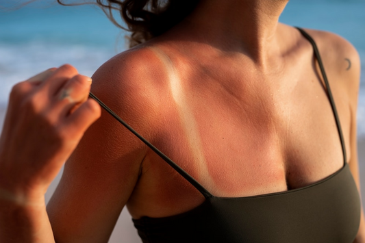 Duo Digest: How to Soothe and Prevent Sunburn